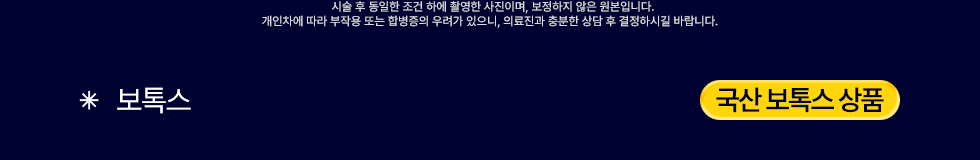 국산 보톡스 상품