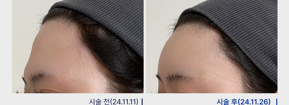 전후사진