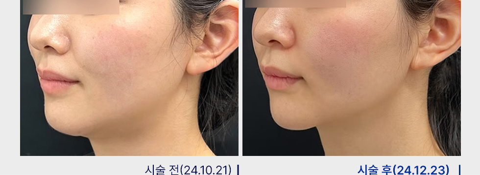 전후사진