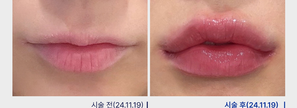 전후사진