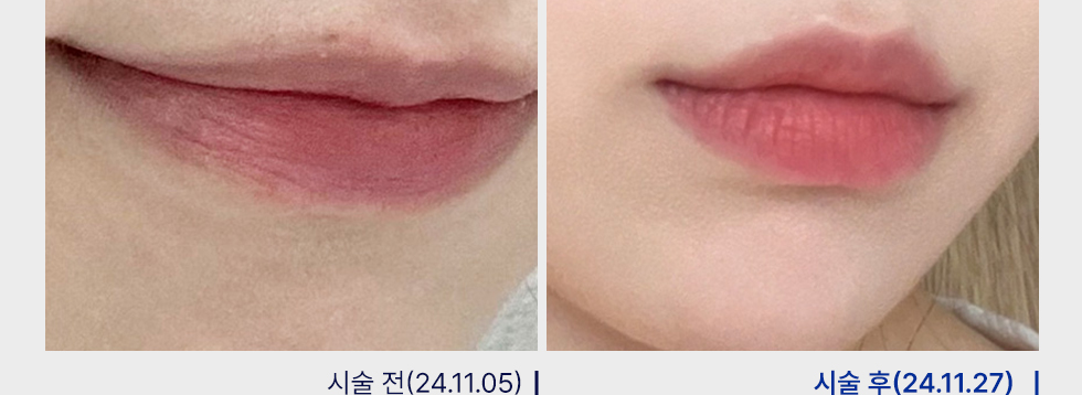 전후사진