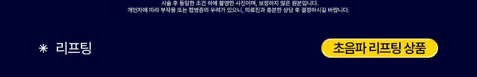 초음파 리프팅 상품