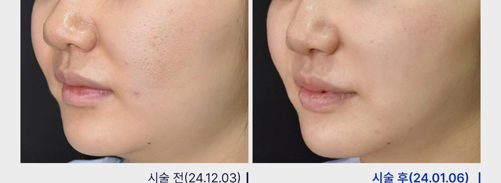 전후사진
