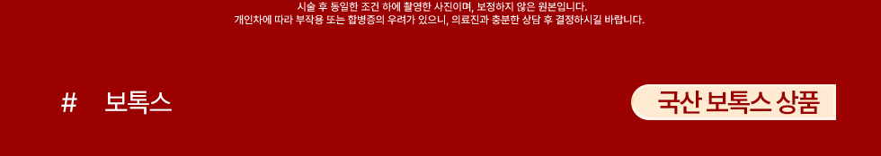 국산 보톡스 상품