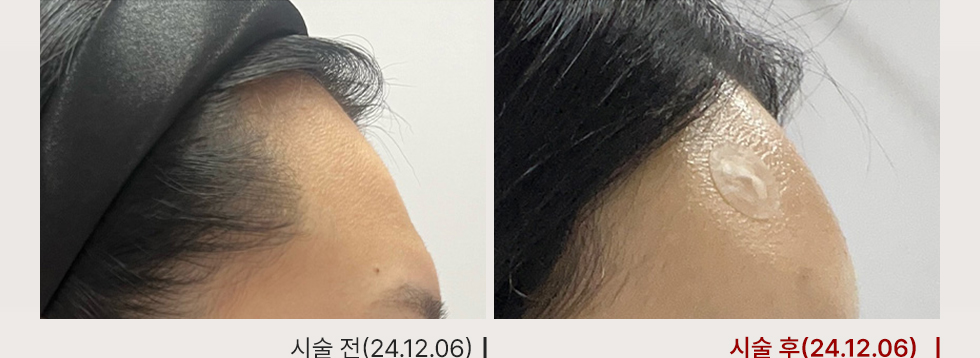 전후사진