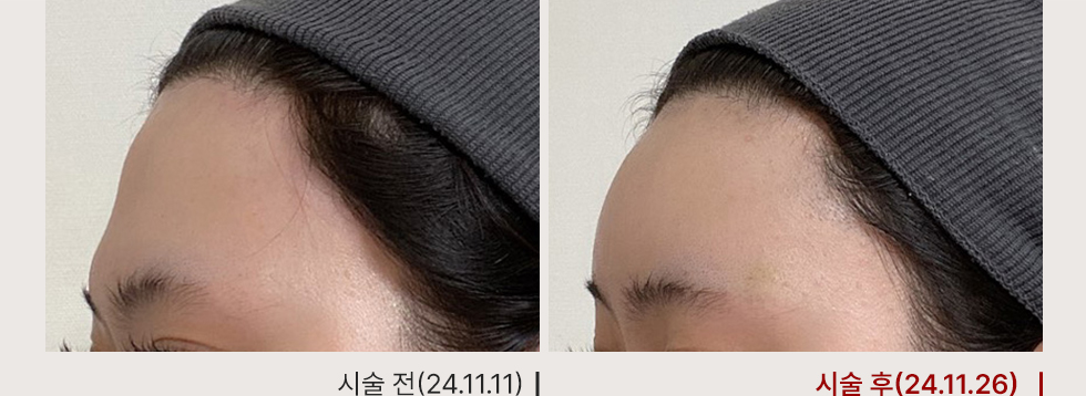 전후사진