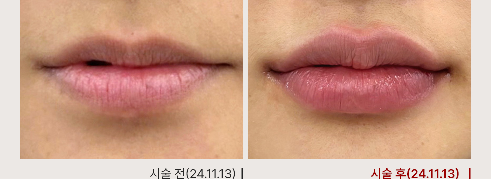 전후사진