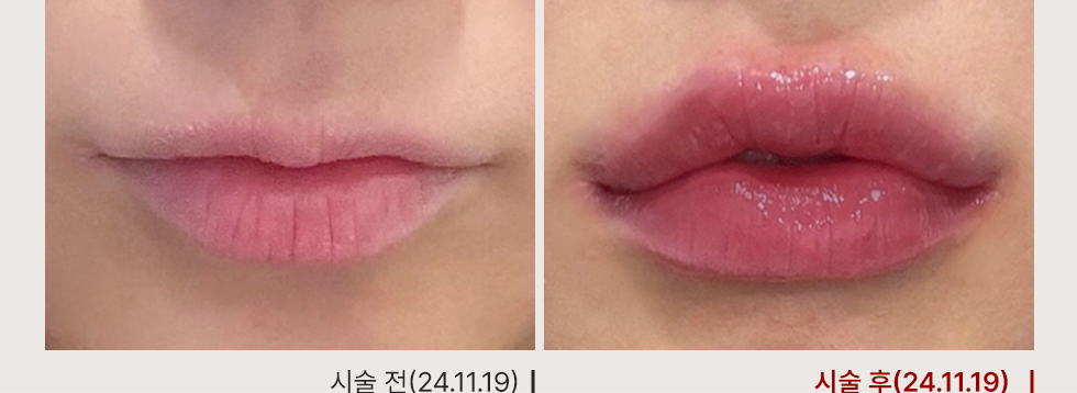 전후사진