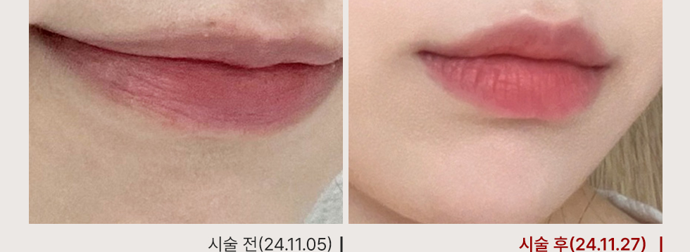 전후사진