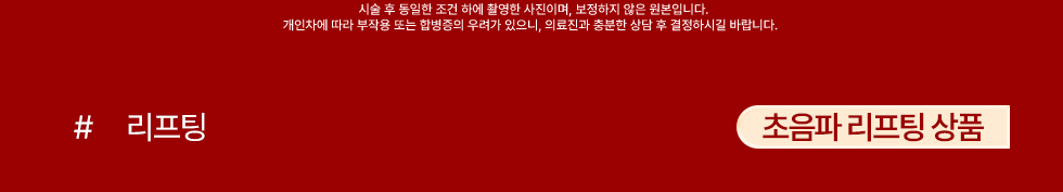 초음파 리프팅 상품