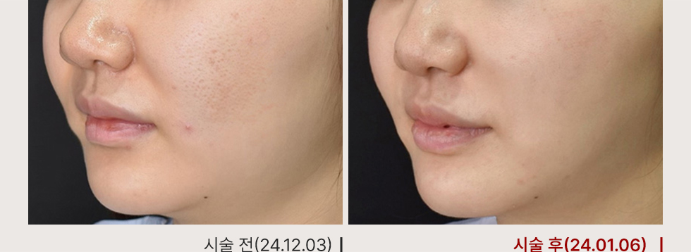 전후사진