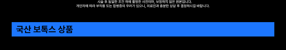 국산 보톡스 상품