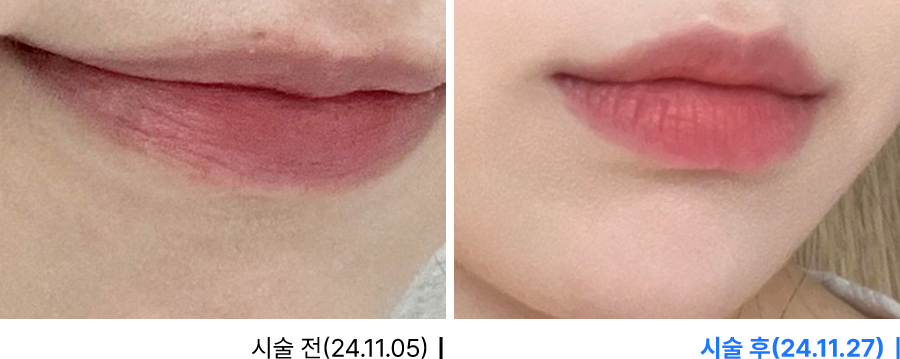 전후사진