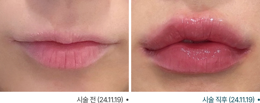 전후사진