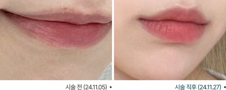전후사진