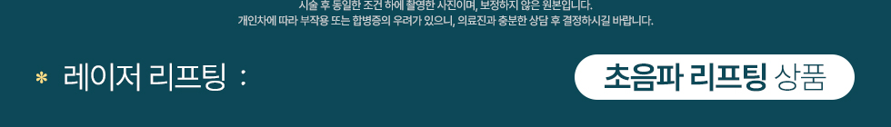 초음파 리프팅 상품