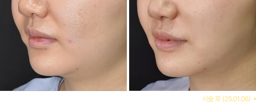 전후사진
