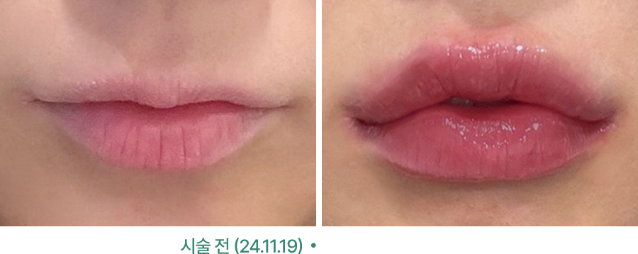 전후사진