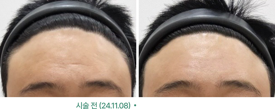 전후사진