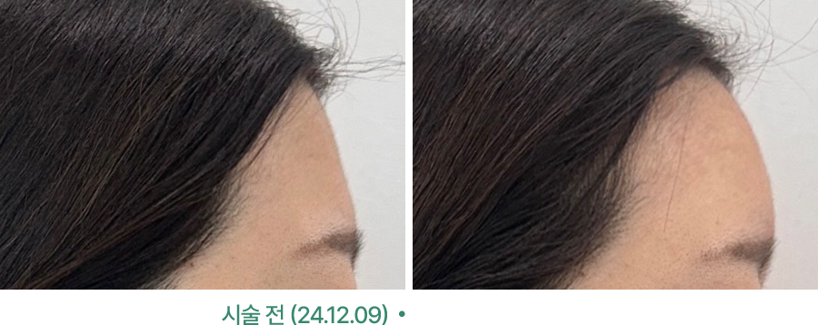 전후사진