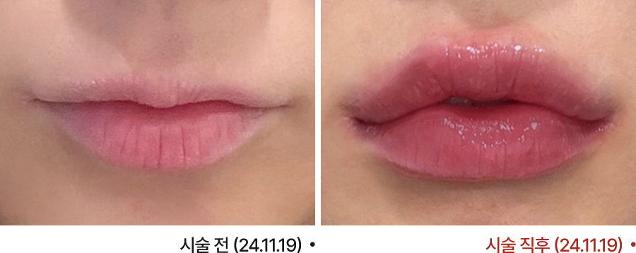 전후사진