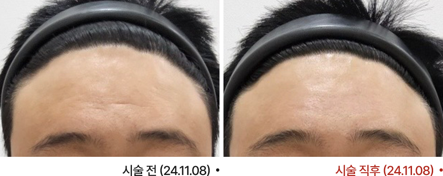 전후사진