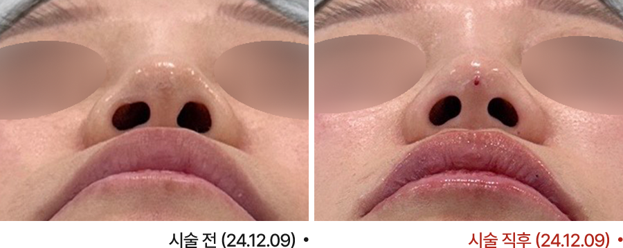 전후사진