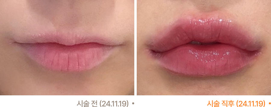 전후사진
