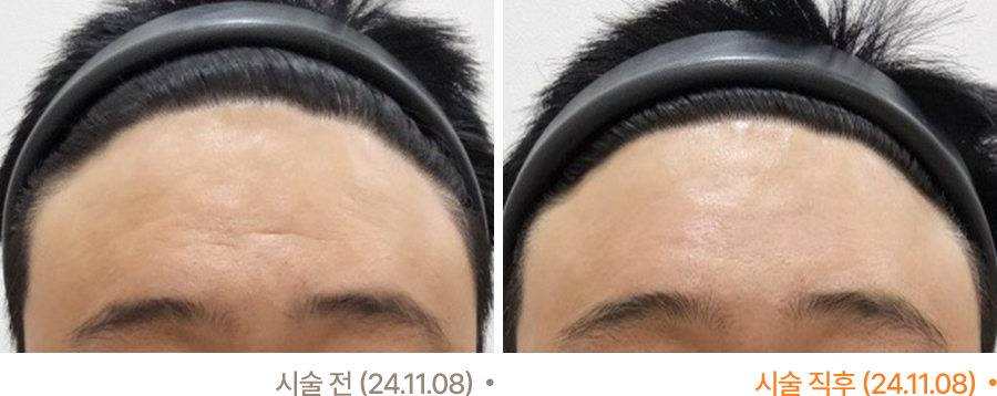 전후사진