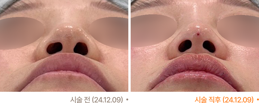전후사진