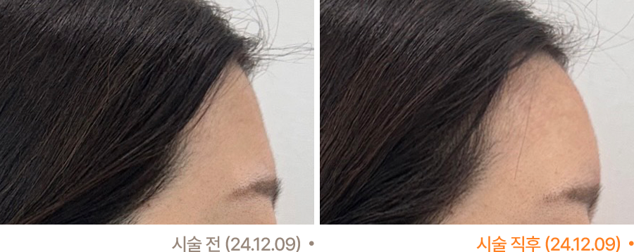 전후사진