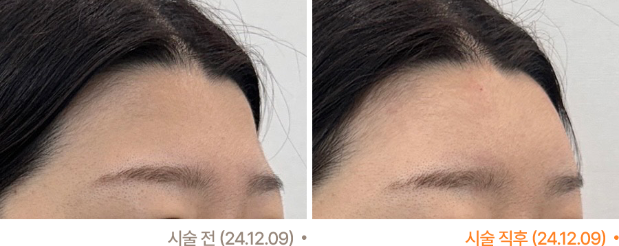 전후사진